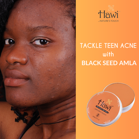 Tackle Teen Acne Naturally with Hawi