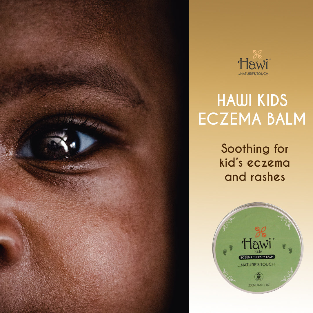 Hawi Kids Eczema Balm - 200ml (6.8 fl oz) | Soothing Relief for Dry & Sensitive Skin