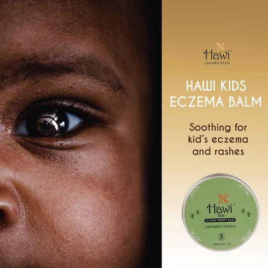 Hawi Kids Eczema Balm 200ml - Soothing Relief for Dry and Sensitive Skin