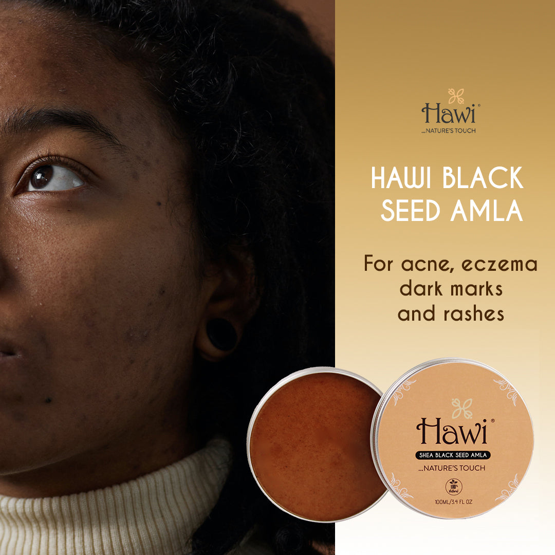 Hawi Blackseed Amla - NET WT 100ml (3.4 fl oz) | Acne & Eczema Relief