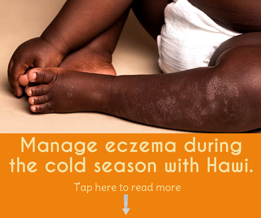 Manage eczema (atopic dermatitis) during the cold season with Hawi.