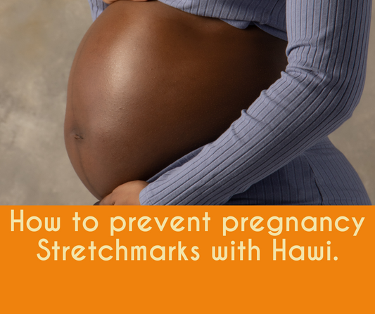 How to Prevent Pregnancy Stretchmarks with Hawi