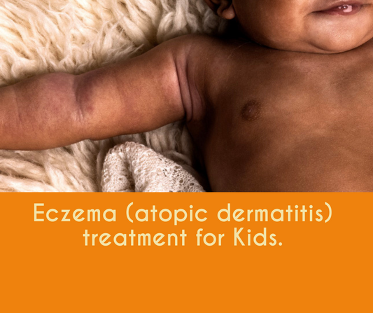 Eczema (atopic dermatitis) treatment for Kids - Hawi Nature's Touch