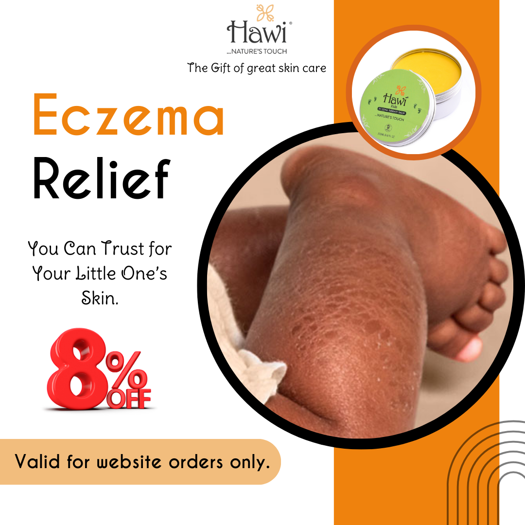 Hawi Kids Eczema Balm - 200ml (6.8 fl oz) | Soothing Relief for Dry & Sensitive Skin