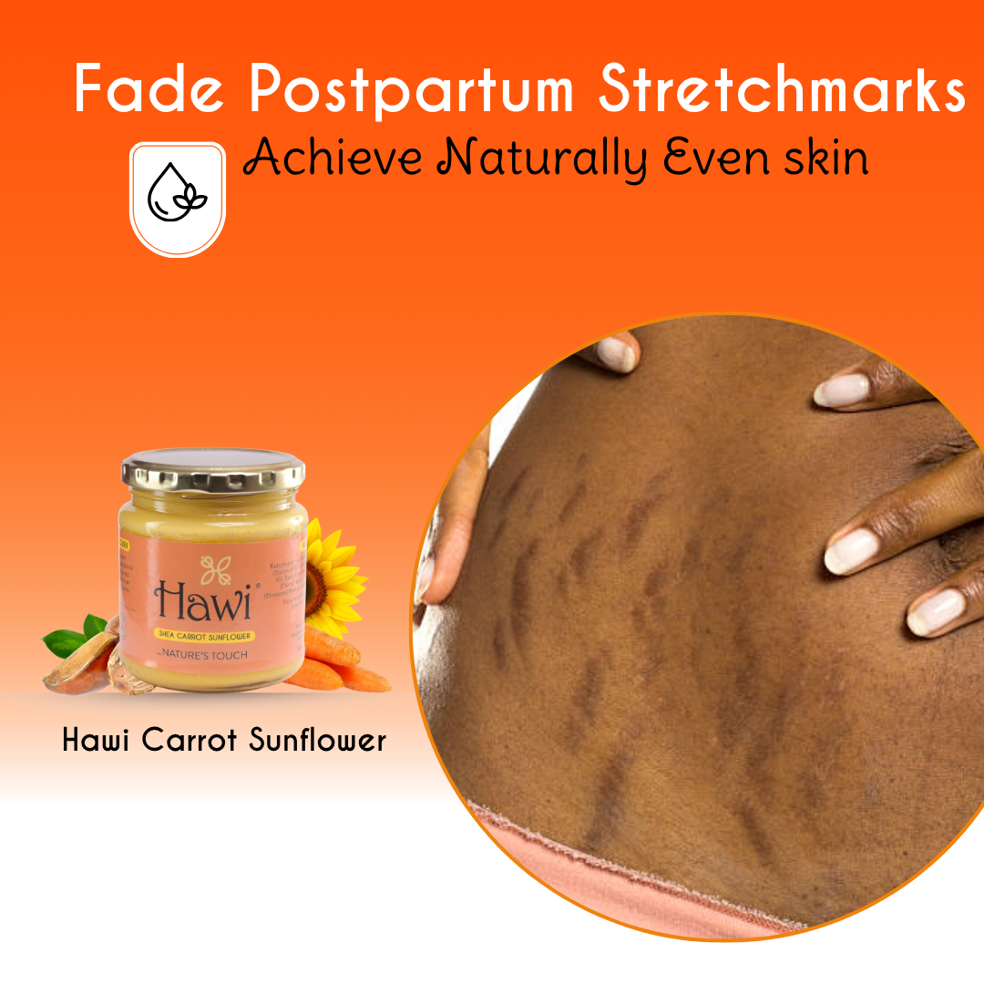 Hawi Carrot Sunflower Moisturizer for Stretch Marks and Dry Skin - NET WT 291ml (9.8 fl oz) - Hawi Nature's Touch