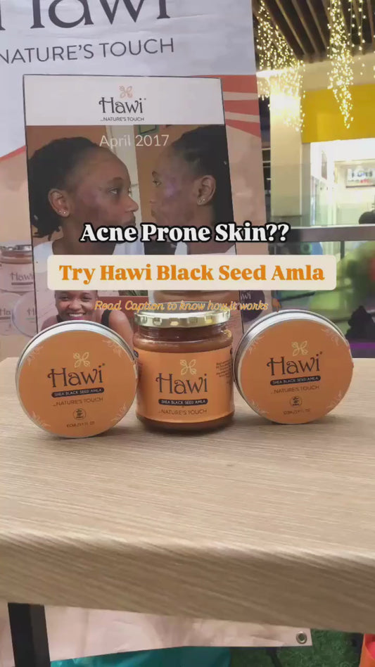 Hawi Blackseed Amla Moisturizer 291ml | Acne & Eczema Relief Cream